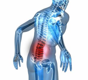 Low Back Pain | StudioXPhys Physio Hope Island, Mudgeeraba