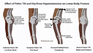 What is Posture | StudioXPhys Physio Hope Island, Mudgeeraba